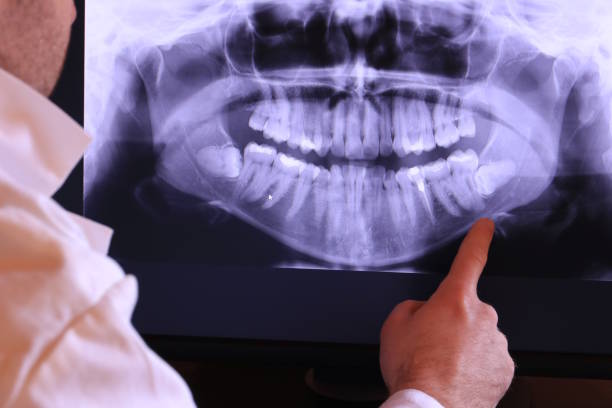 Best Emergency Gum Treatment in Warrington, FL